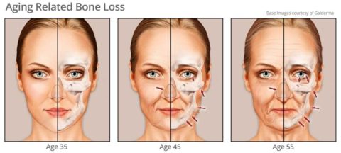 Understanding Facial Aging New Orleans, LA | New Orleans Facial Aging